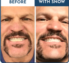Customer Before & After Result 1