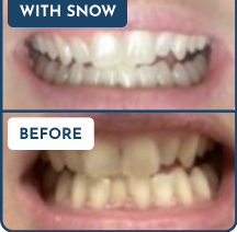 Customer Before & After Result 2