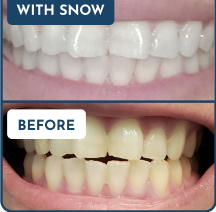 Customer Before & After Result 4