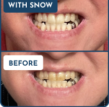 Customer Before & After Result 5