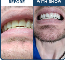 Customer Before & After Result 6